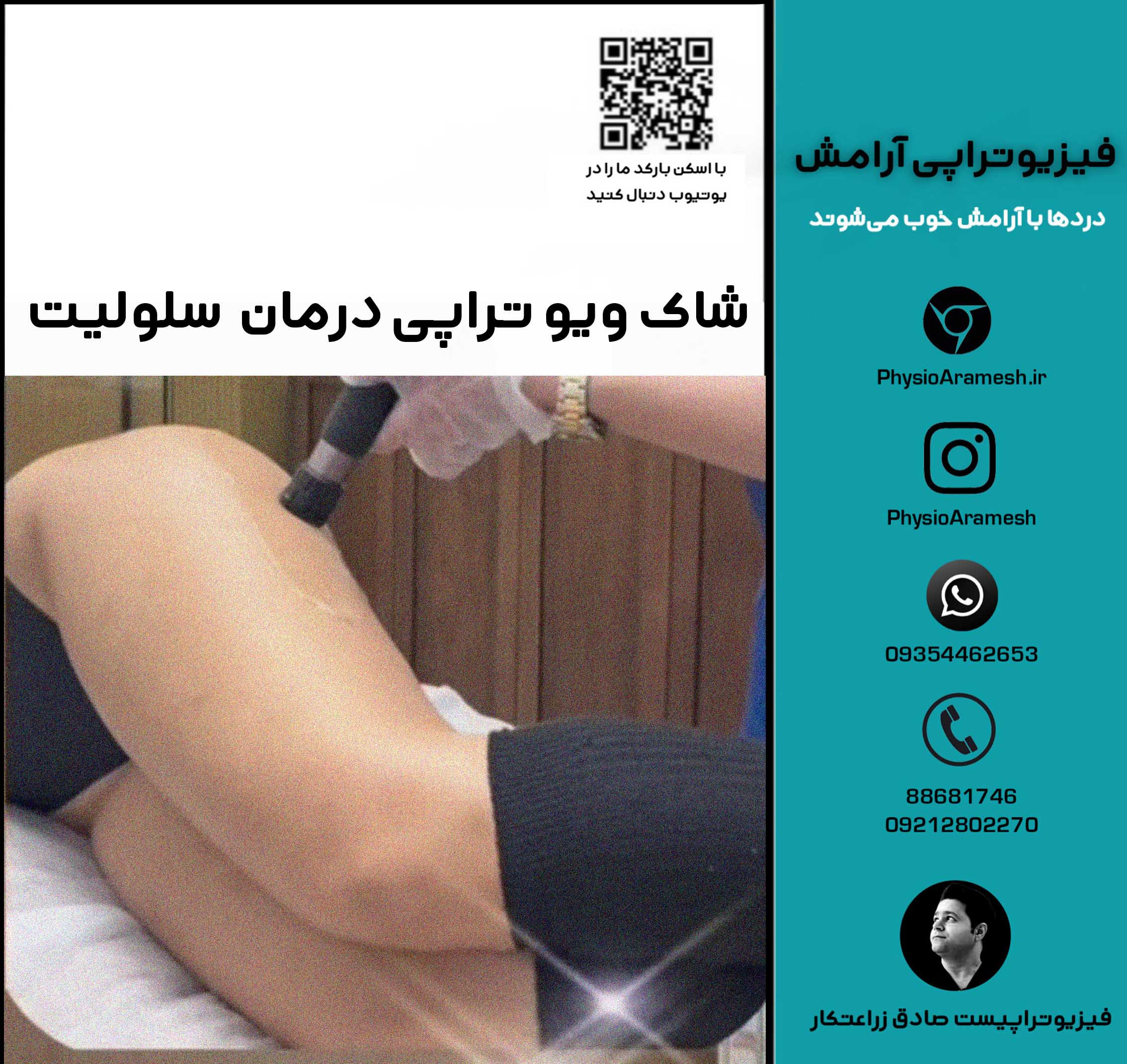 شاک ویو تراپی درمان  سلولیت